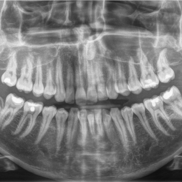 Oralxcucuta-14